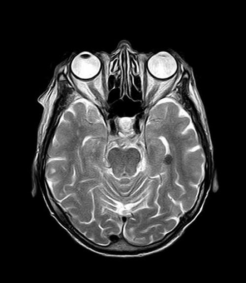 		 Brain cross section
	